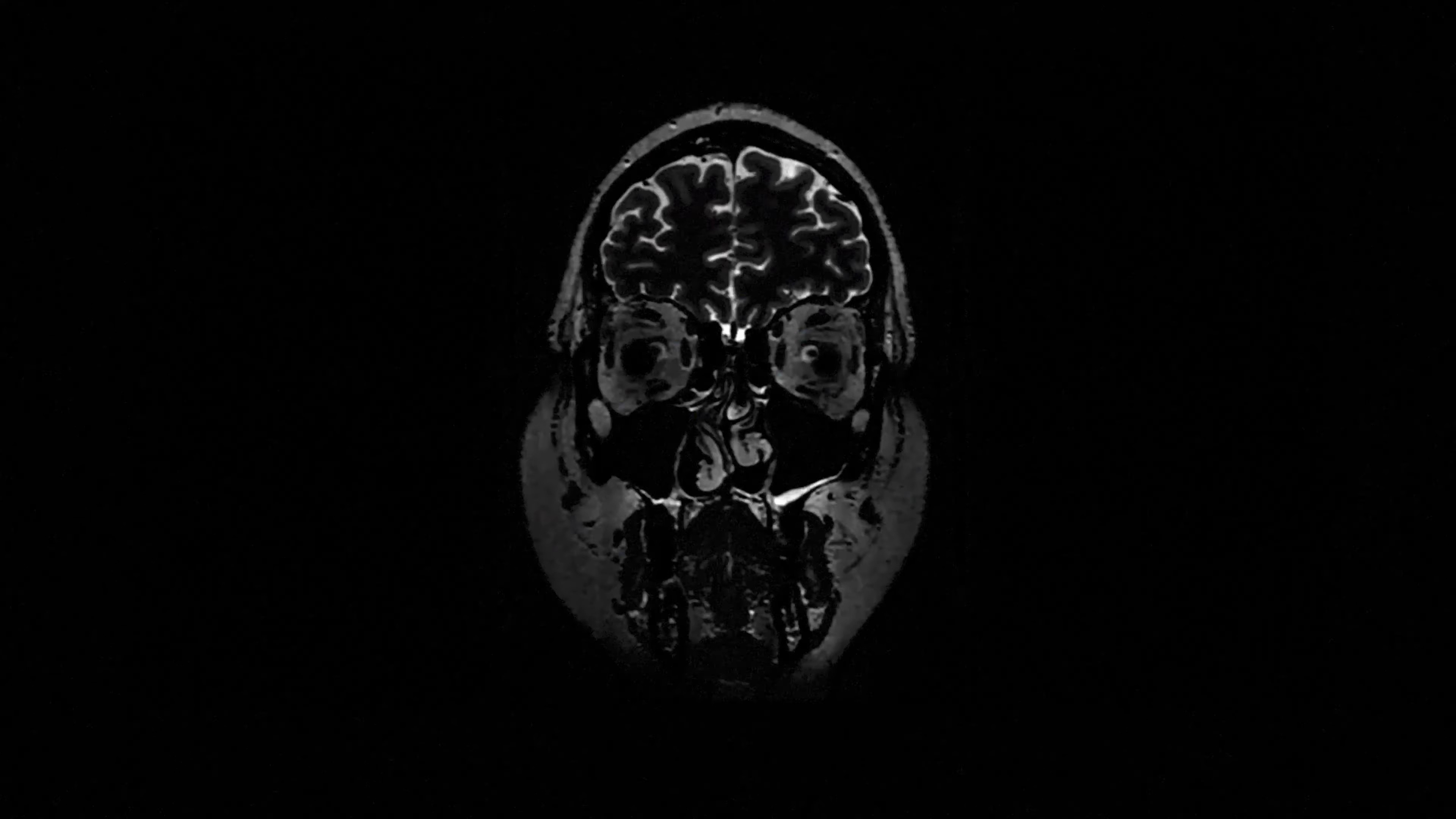 bleach (2025) —  shot,  lighting