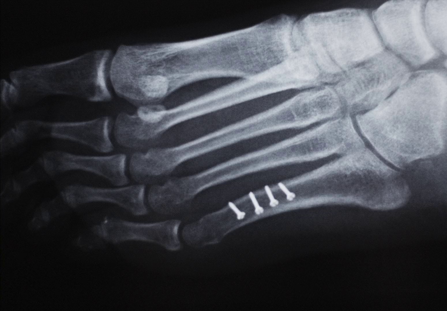 FMH - Director's Cut (2024) —  shot,  lighting