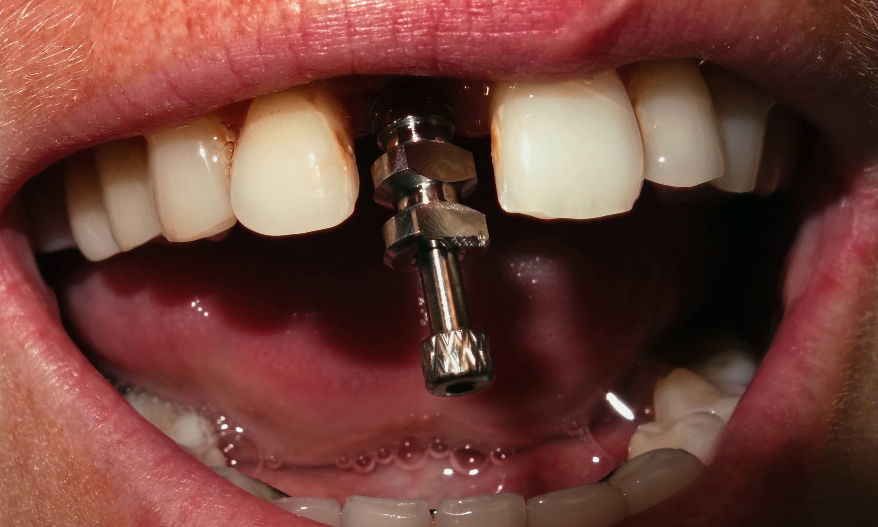 Máquina Culona (2023) —  shot,  lighting