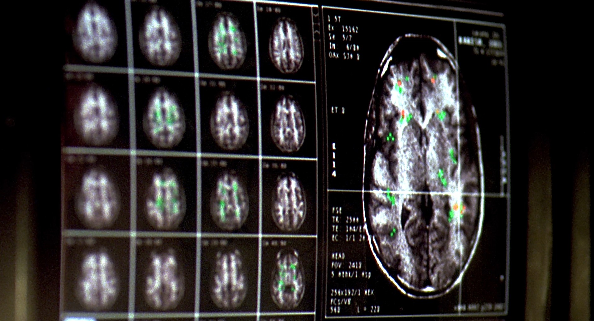 Eternal Sunshine of the Spotless Mind (2004) —  shot,  lighting