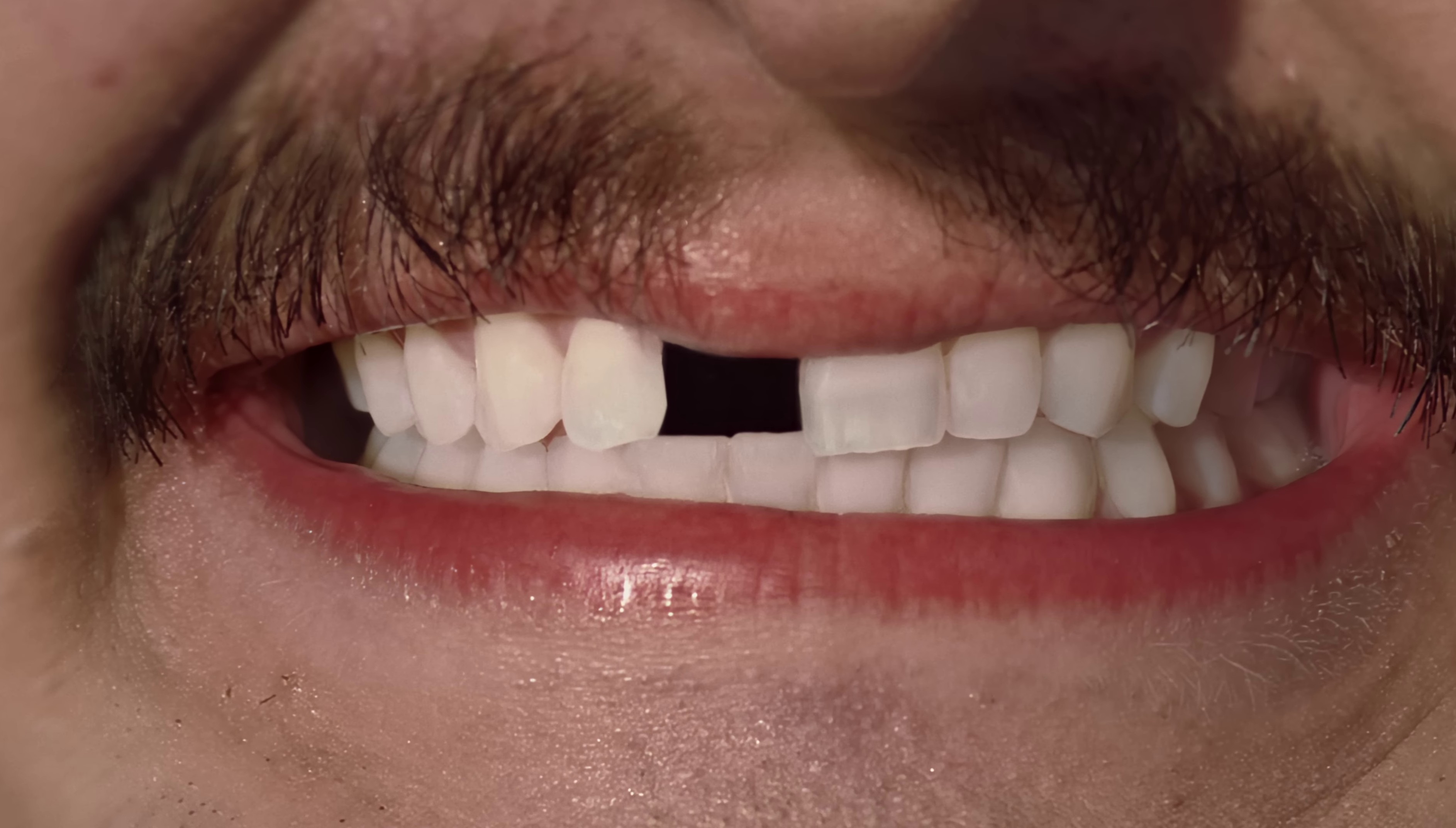 One & Only (2023) —  shot,  lighting