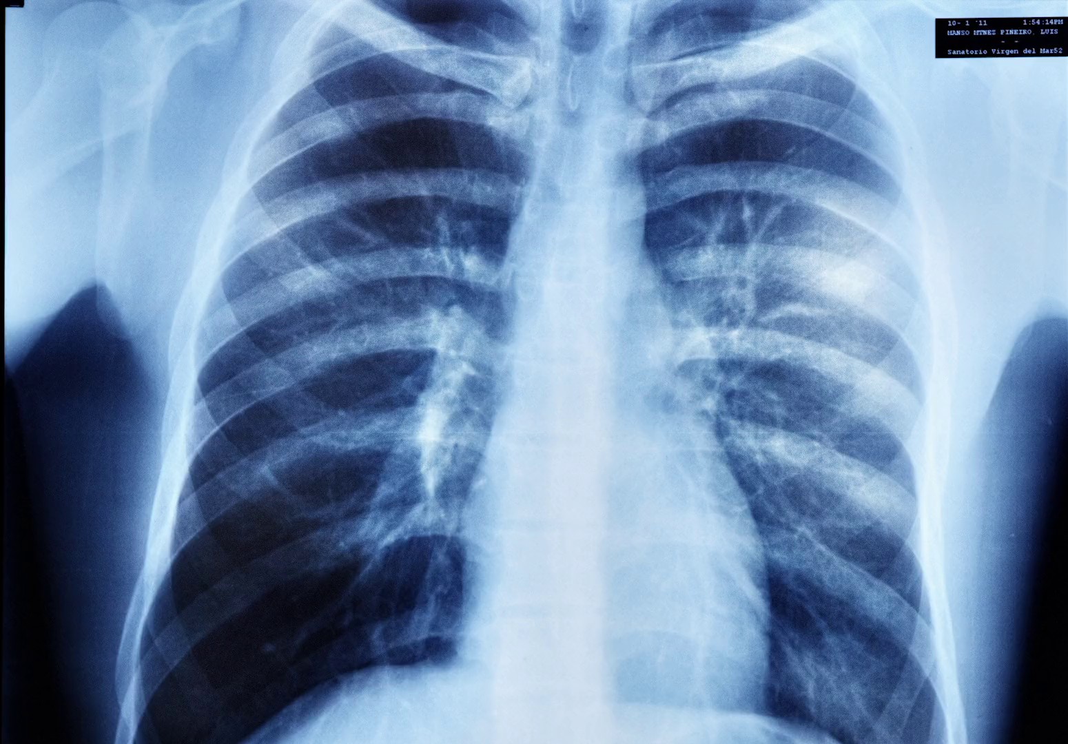 FMH - Director's Cut (2024) —  shot,  lighting