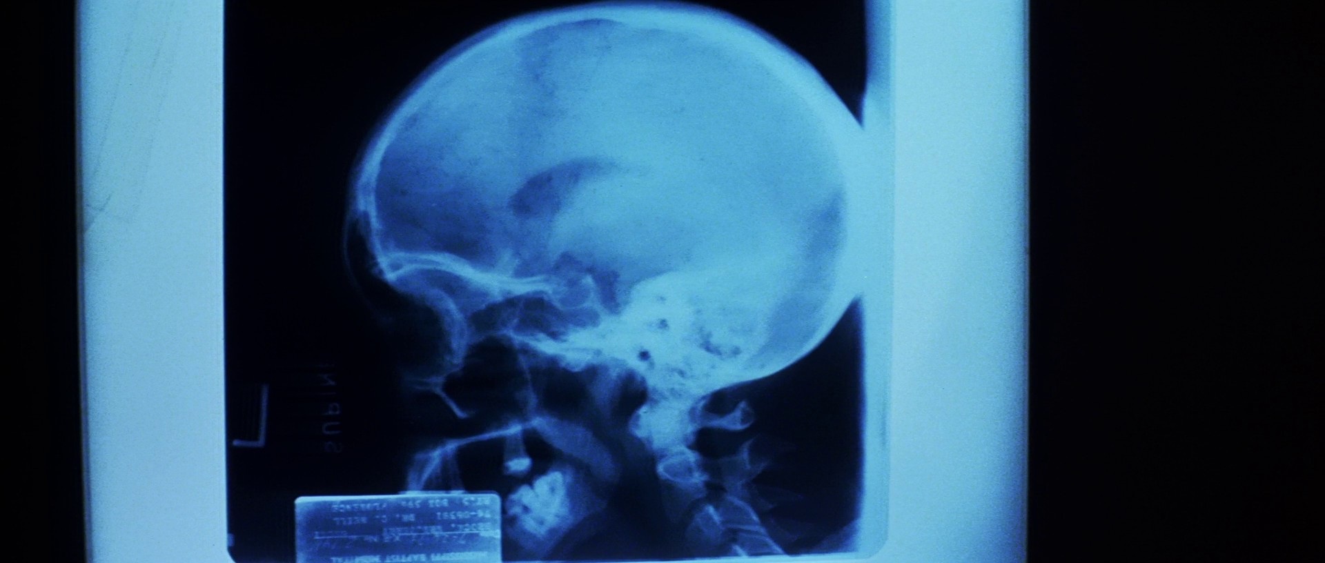 The Beast Within (1982) —  shot,  lighting